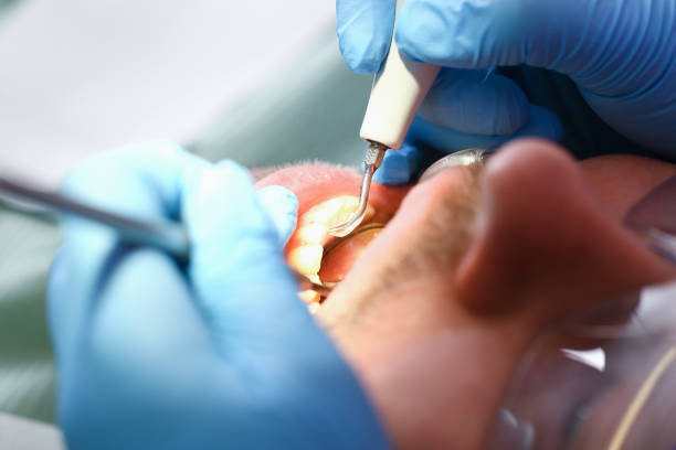 Best Cracked Tooth Emergency Dentist  in Medina, OH