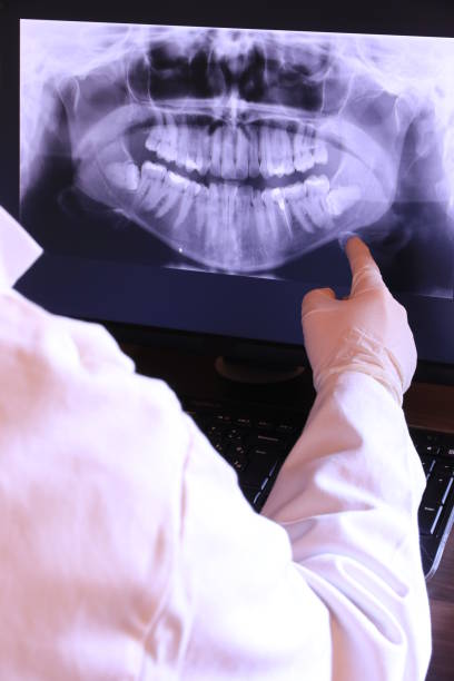 Best Chipped Tooth Repair Near Me  in Medina, OH