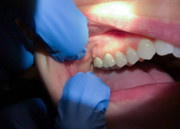 Best Tooth Pain Emergency Relief  in Medina, OH